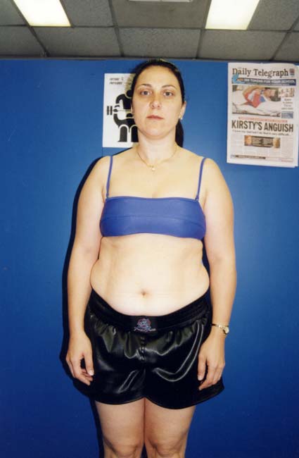 Beginners Weight Lifting Program - Before Photo